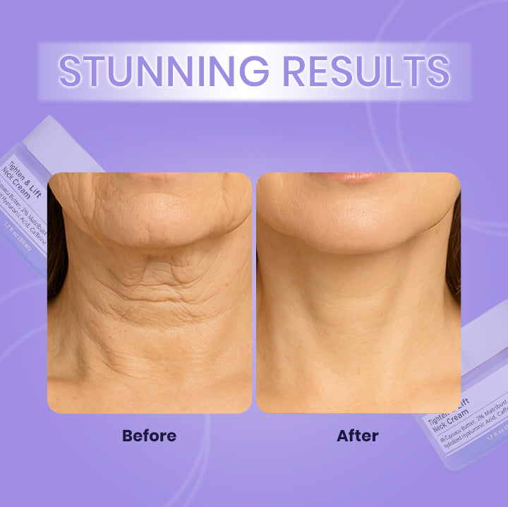 Tighten & Lift Neck Cream